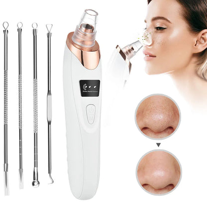 SwiftCart® Blackhead Remover Vacuum | USB Pore Cleaner - SwiftCart